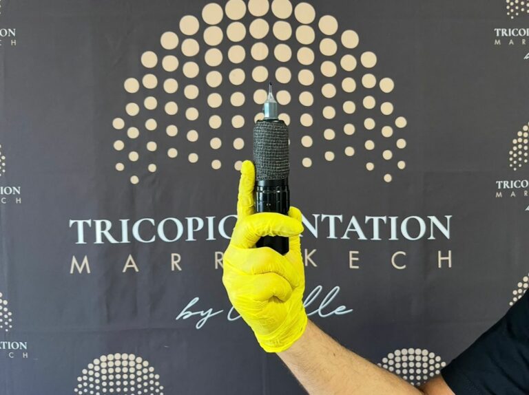 La Tricopigmentation : Une Solution Innovante pour Retrouver une Chevelure Dense
